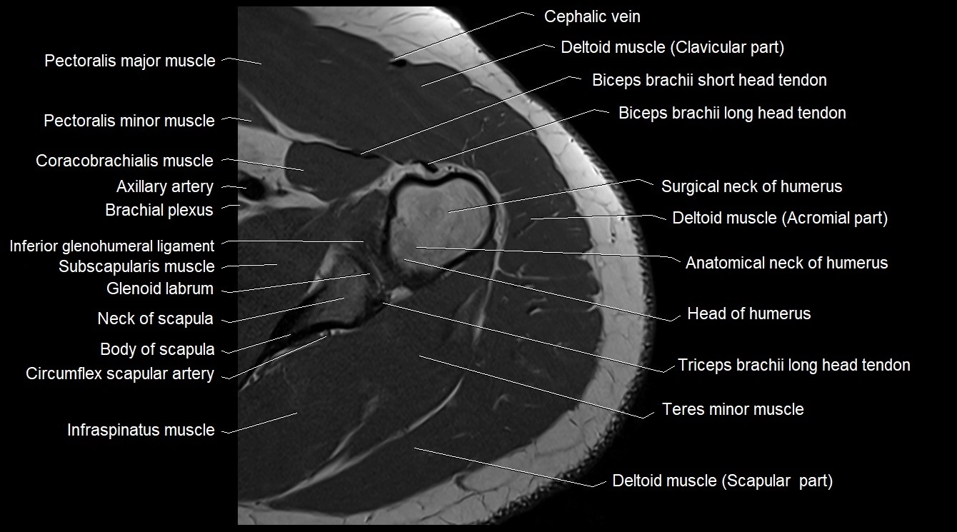 Upper arm( humerus) cross section anatomy MRI 3T axial image 14.webp